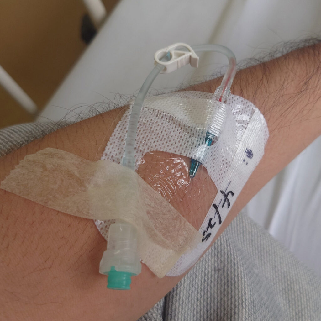 点滴用針を腕に刺す